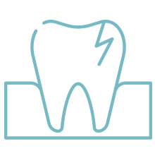 虫歯の治療と予防